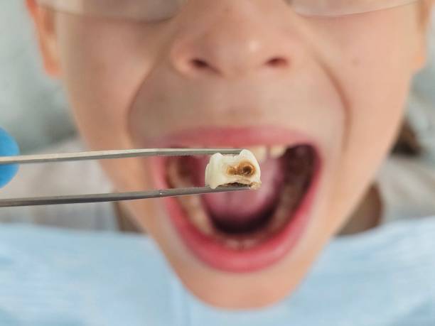 Best Emergency Dental Surgery in Orange City, FL