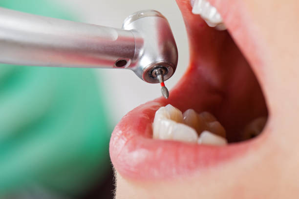 Best Walk-In Emergency Dentist in Orange City, FL